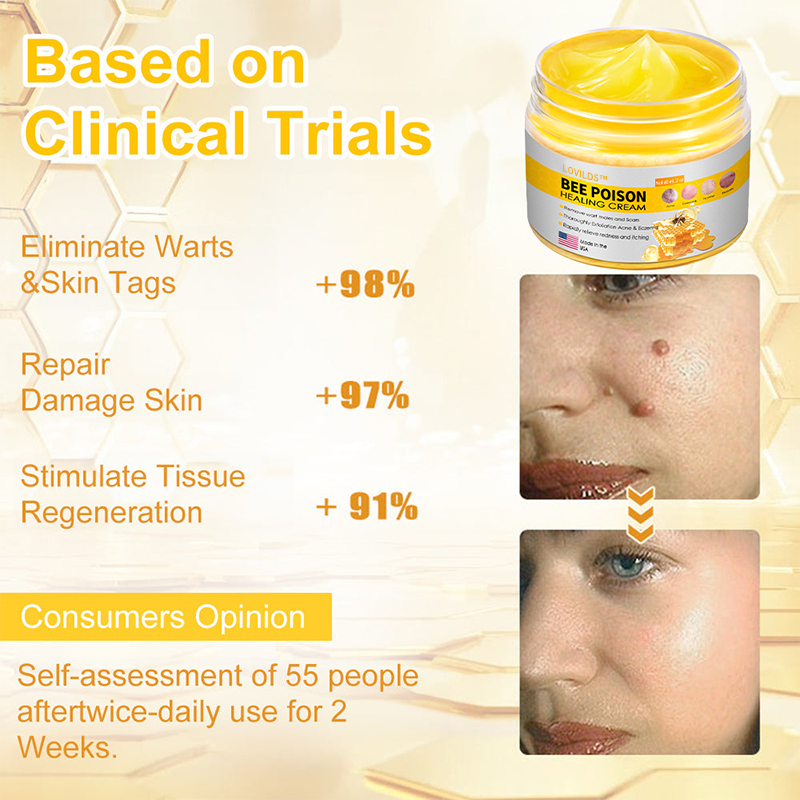 LOVILDS™ BEE POISON Skin Cream(👨⚕AAD Recommended),for Remove Warts, Acne and Scars