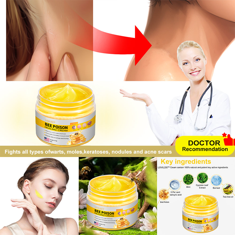 LOVILDS™ BEE POISON Skin Cream(👨⚕AAD Recommended),for Remove Warts, Acne and Scars