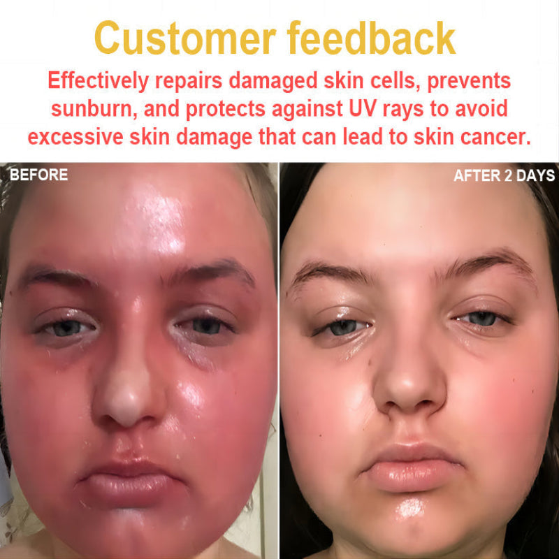 LOVILDS™ BEE POISON Skin Cream(👨⚕AAD Recommended),for Remove Warts, Acne and Scars