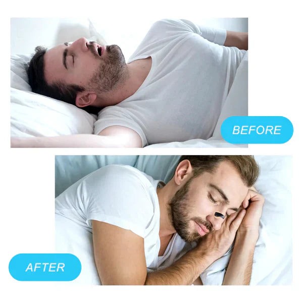 Magnetic Nose Patch – Breathing Expander Keeping You Breathing, Naturally. - 🔥 up to 83% off 🎁