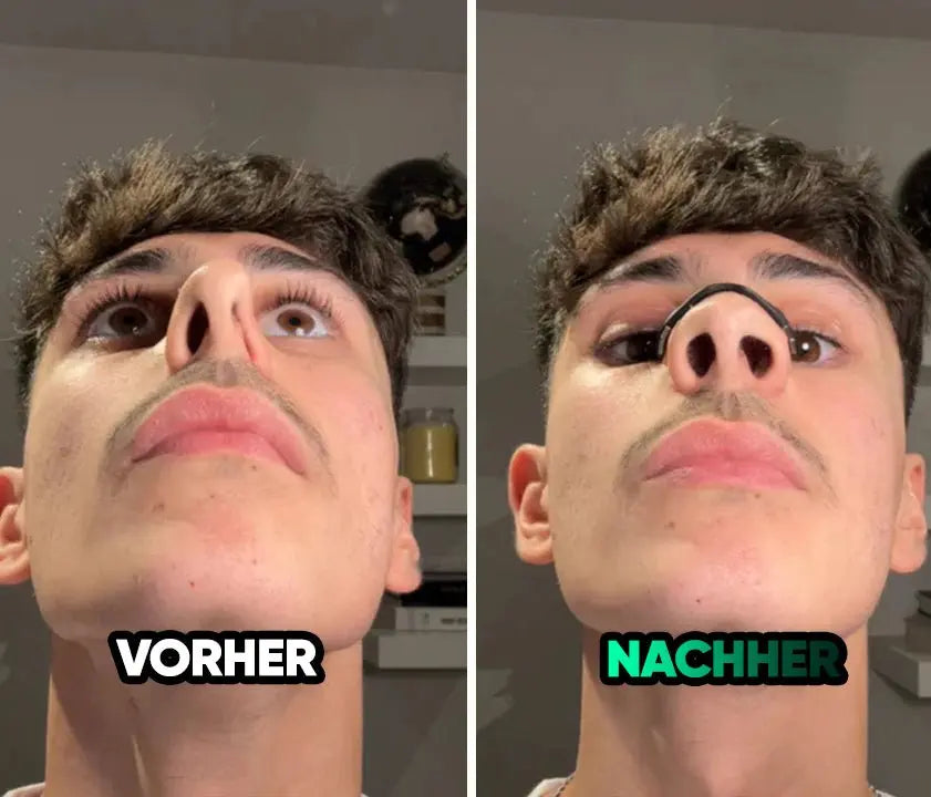 Magnetic Nose Patch – Breathing Expander Keeping You Breathing, Naturally. - 🔥 up to 83% off 🎁