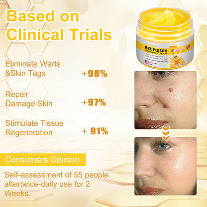 LOVILDS™ BEE POISON Skin Cream（👨‍⚕AAD Recommended),for Remove Warts, Acne and Scars