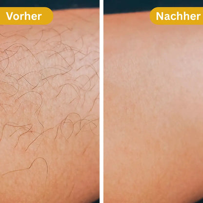 🌸5 Min Miracle Hair Removal Powder – Quick, Safe & Silky Results✅